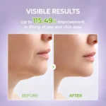 ماسک هیدروژلی خط فک Cactox دکتر ملاکسین